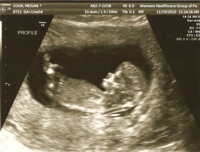 Peanut - 2010112901 "Peanut" Cook